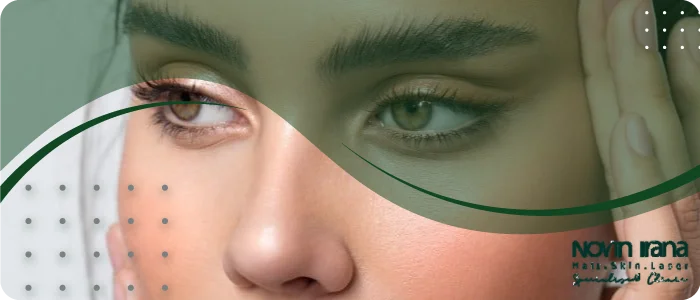 مراقبت های قبل کاشت ابرو